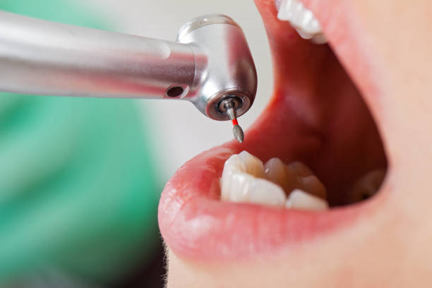 Best Cosmetic Emergency Dentistry in Whiskey Creek, FL